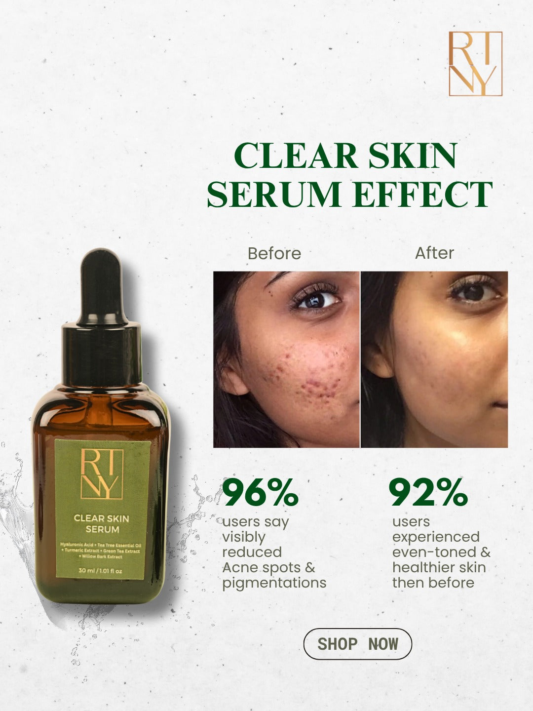 Clear skin serum